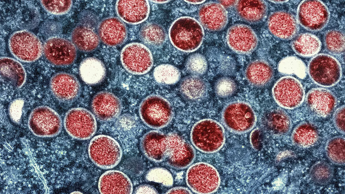 New pandemic: the virus in Africa is causing concern for the WHO